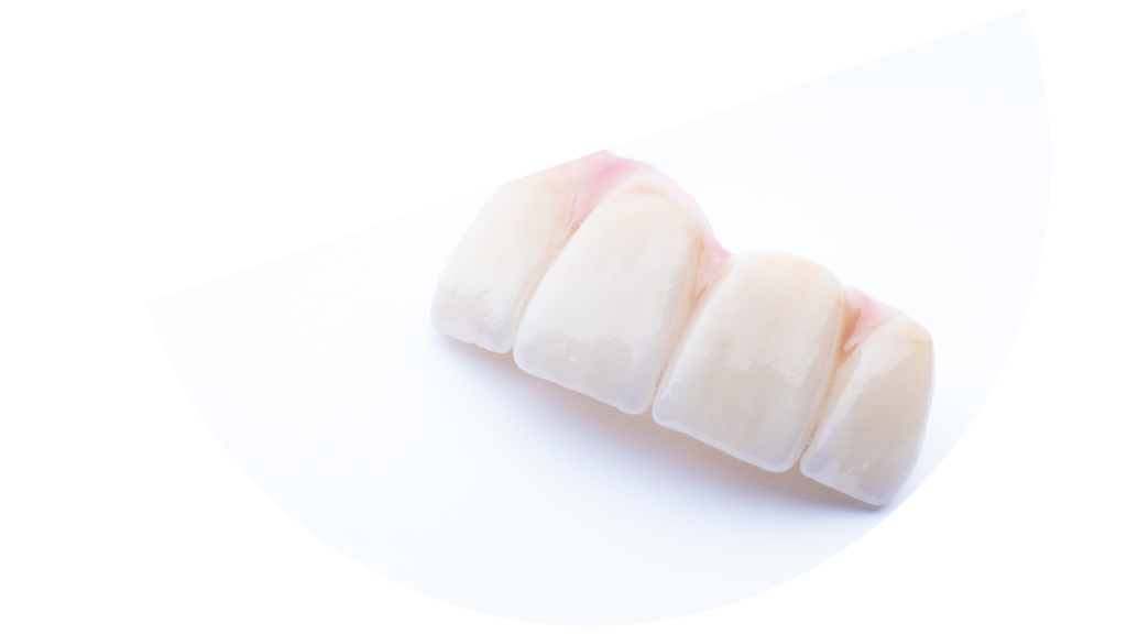 Corone e Ponti Dentali