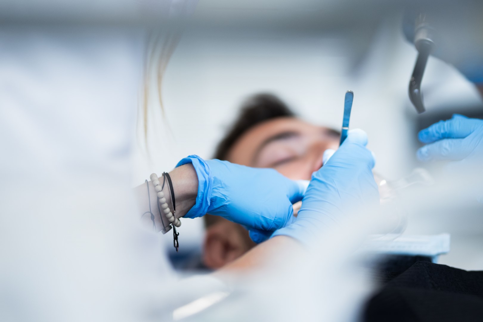 Laser terapia gengive e carie